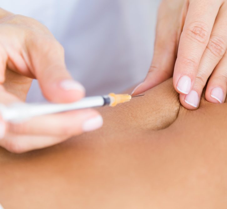 Eine Hand mit Spritze. Eine  eine Biopunktur Injektion wird unter die Haut gespritzt.